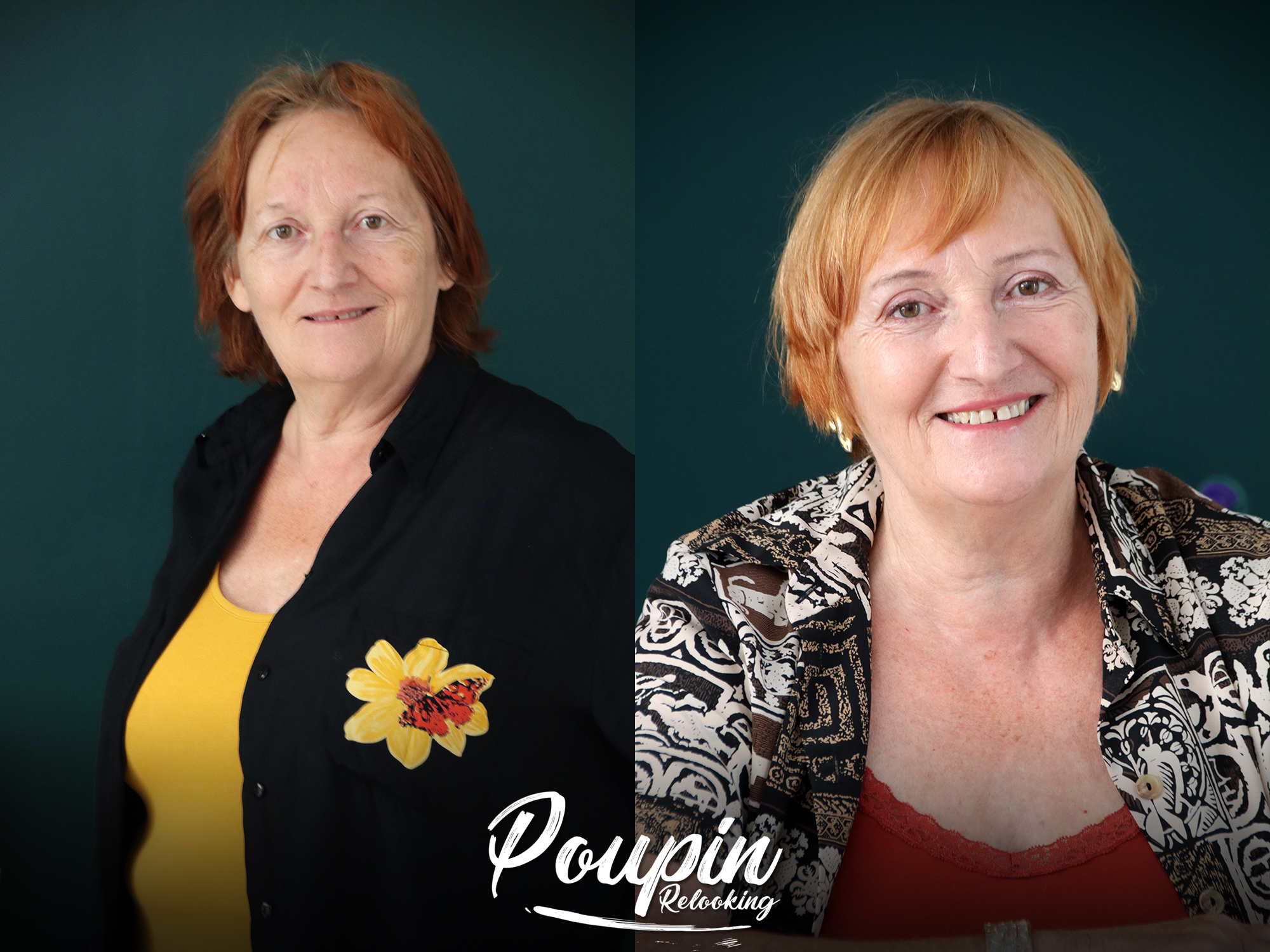 Relooking visage de Annick à Aigrefeuille - 66 ans