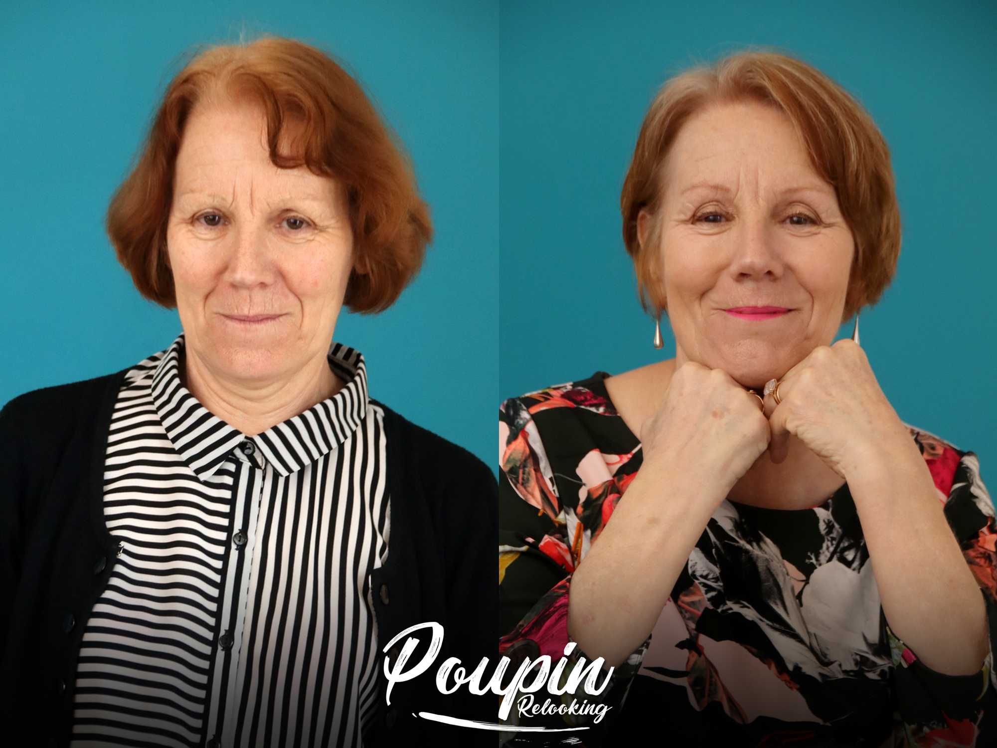 Relooking visage de Marythe à Chantonnay - 62 ans